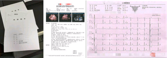 该院体检中心的体检报告示例